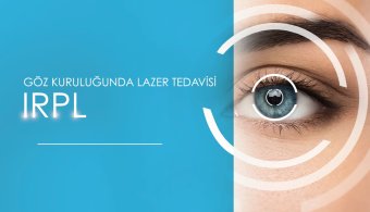 Laser Treatment for Dry Eyes – IRPL